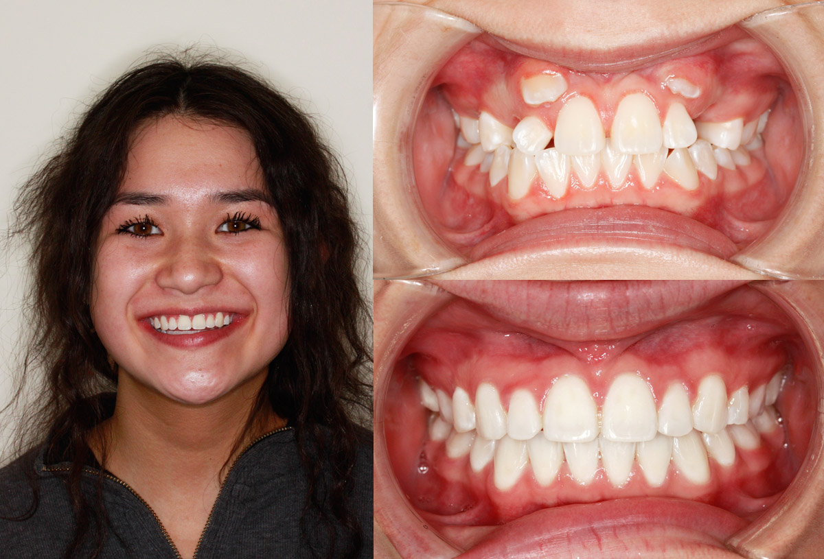 Bailey D ⋆ Silcox Orthodontics